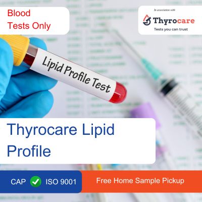 Thyrocare Lipid Profile