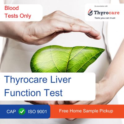 Thyrocare Liver Function Test