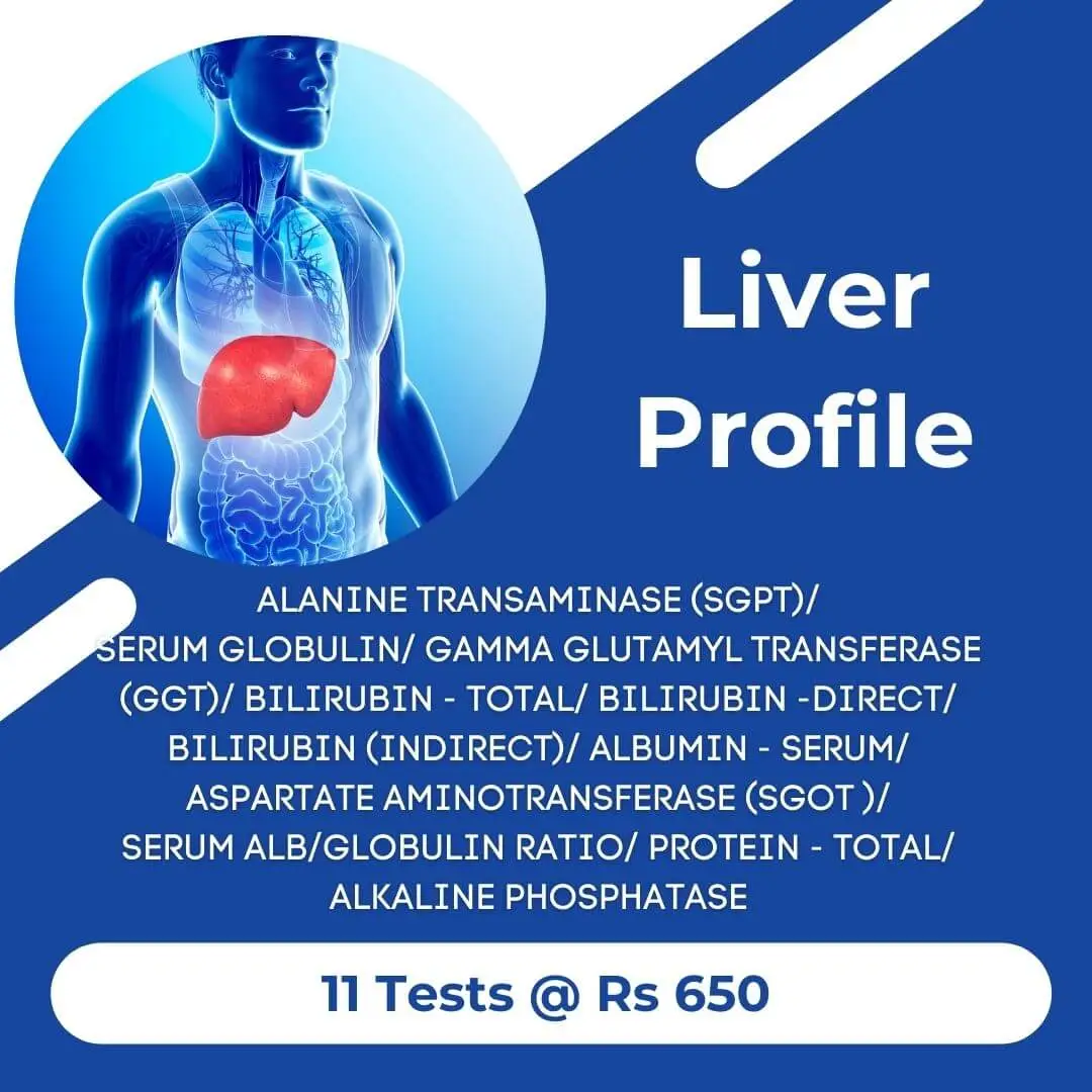 Thyrocare Liver Profile LFT