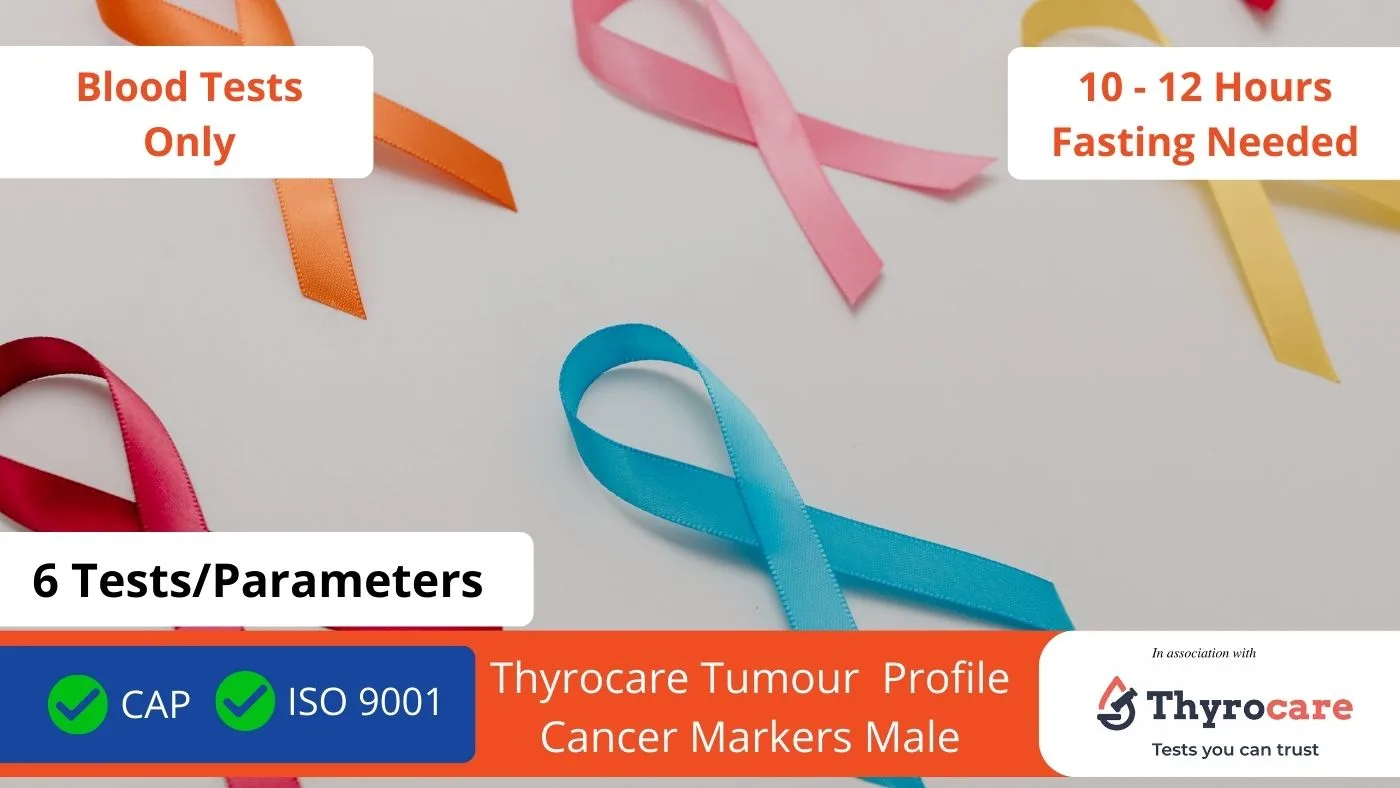 Thyrocare Tumour Profile Cancer Markers Male