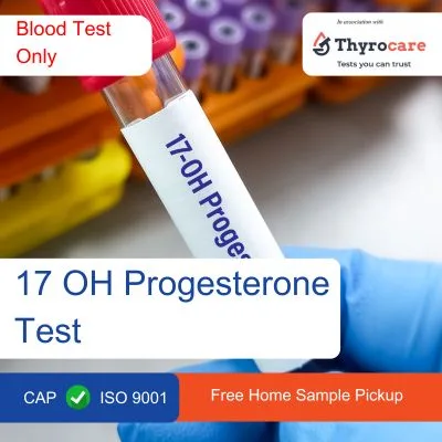 17 OH Progesterone Test