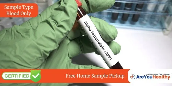 Alpha Fetoprotein Test