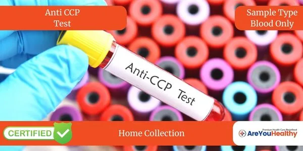 Anti CCP Test