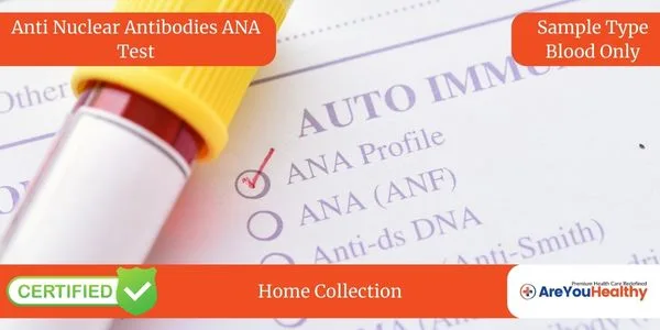 Anti Nuclear Antibodies ANA Test