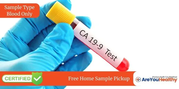 CA 19.9 Test