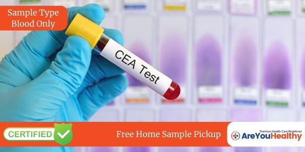 Carcino Embryonic Antigen (CEA) Test | Rs 500 | Thyrocare