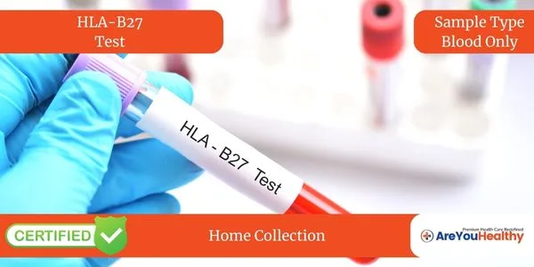 HLAB27 TEST