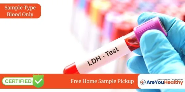 Lactate Dehydrogenase Test