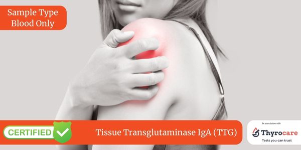 Tissue Transglutaminase IgA (TTG) Test