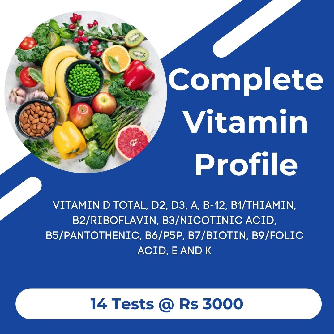 Thyrocare Complete Vitamin Profile Test List