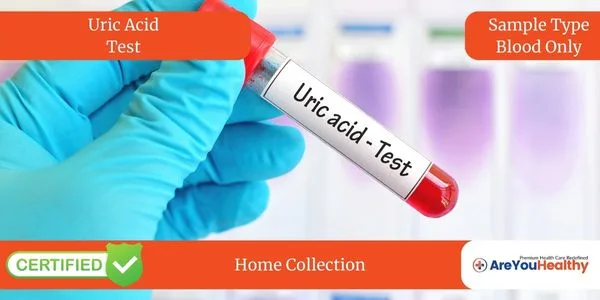 Uric Acid Test