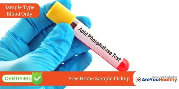 Acid Phosphatase Test