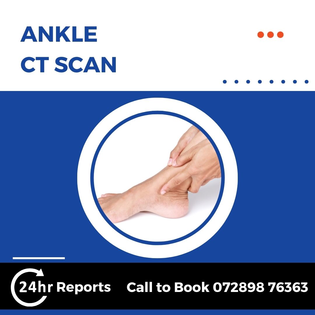 Ankle CT Scan