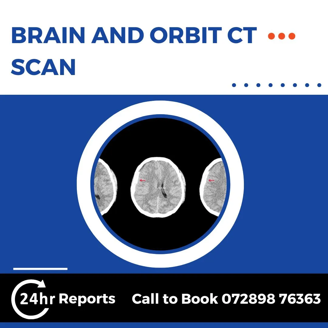 Brain And Orbit CT Scan