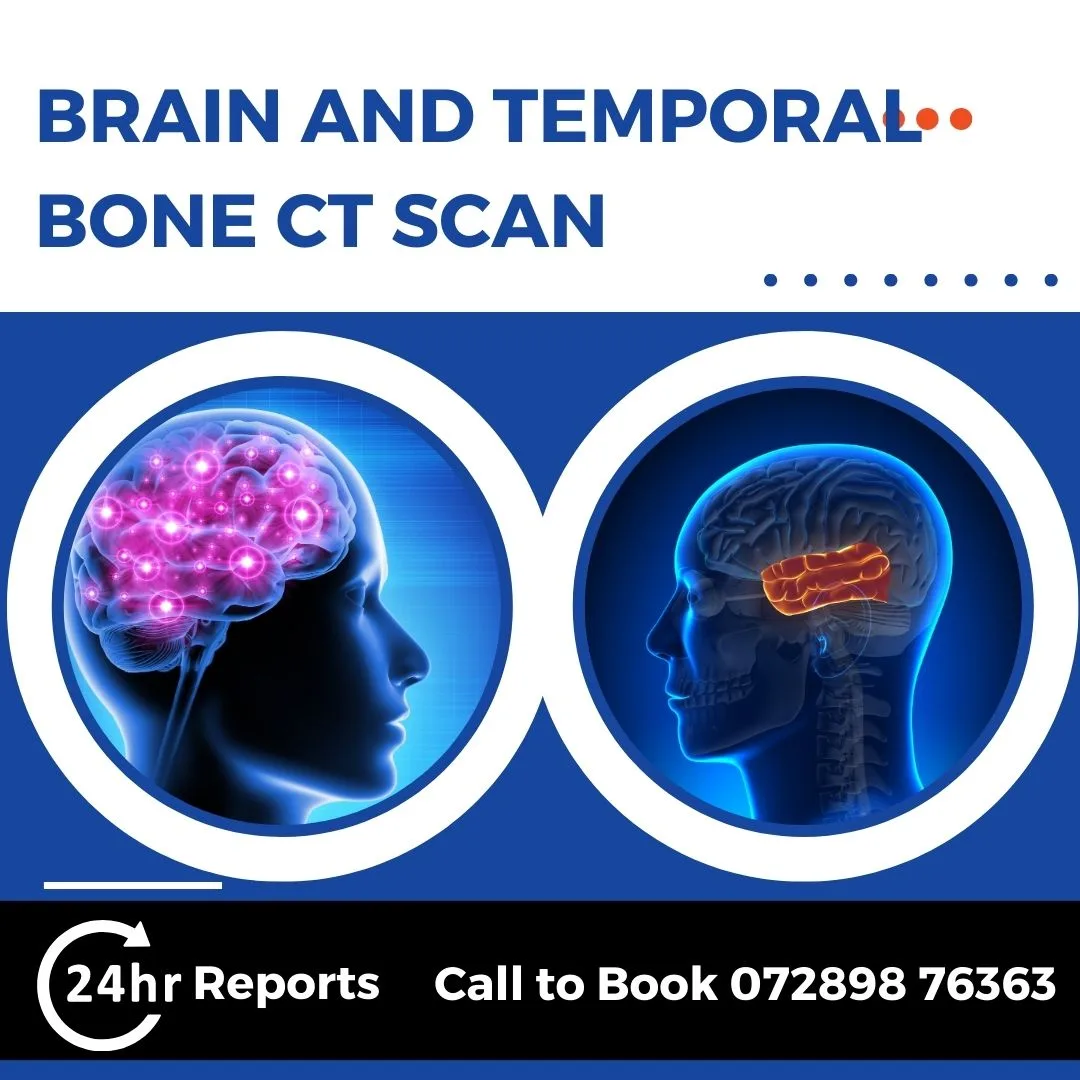 Brain And Temporal Bone CT Scan