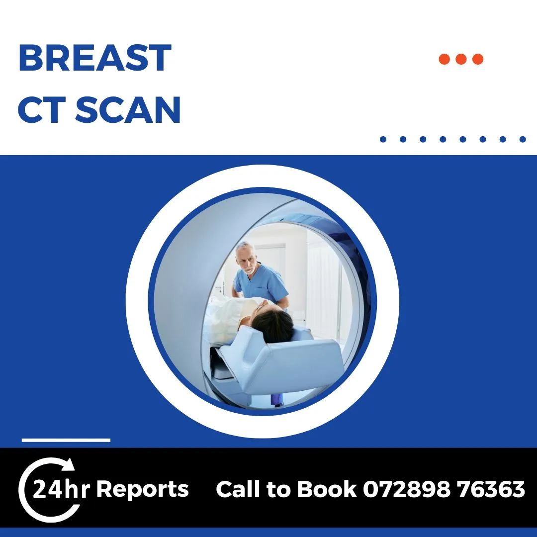 Breast CT Scan