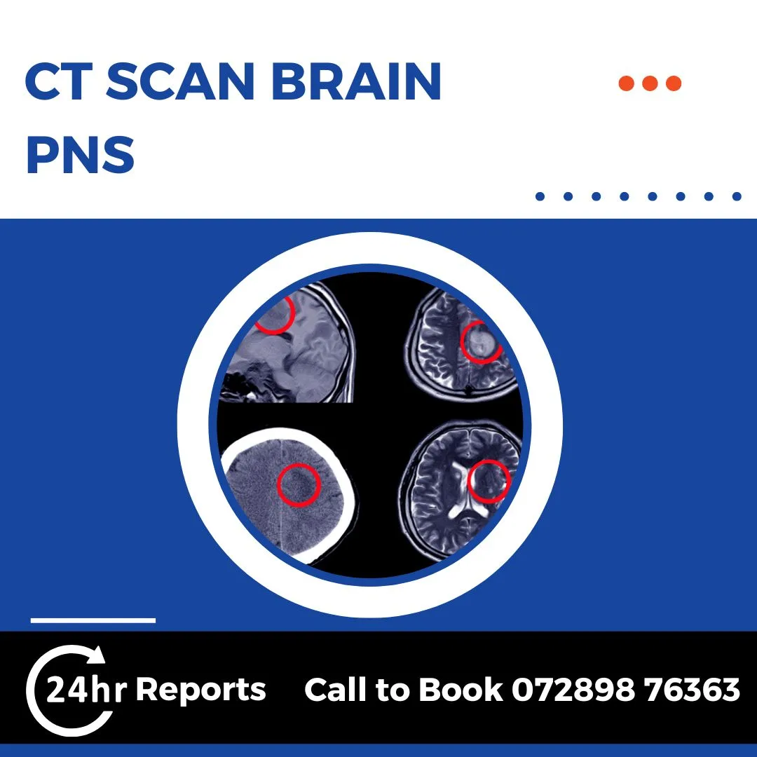 CT Scan Brain Pns