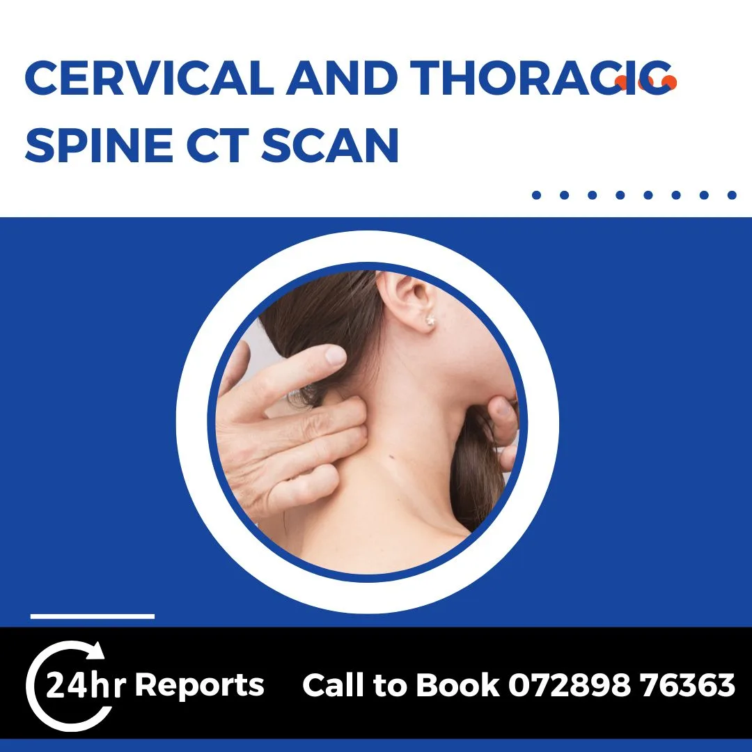 Cervical And Thoracic Spine CT Scan