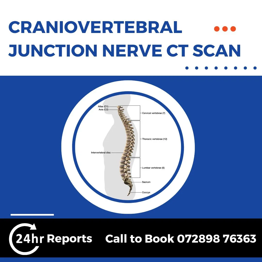 Craniovertebral Junction Nerve CT Scan
