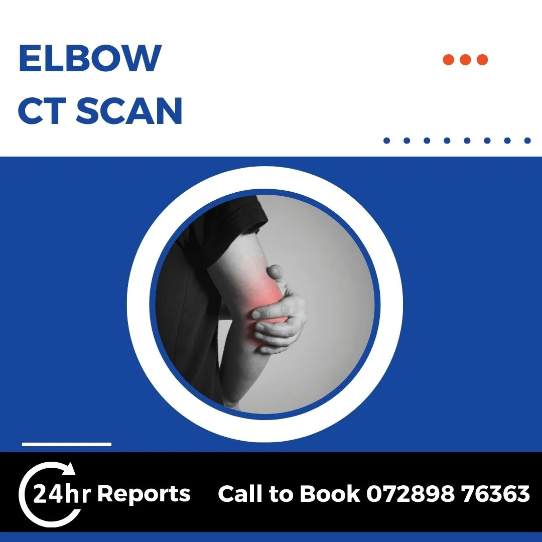 Elbow CT Scan