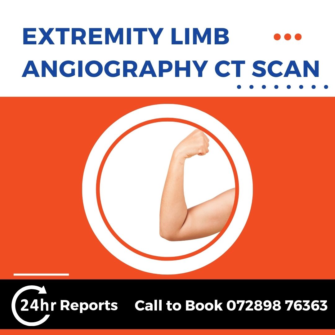 Extremity Limb Angiography CT Scan