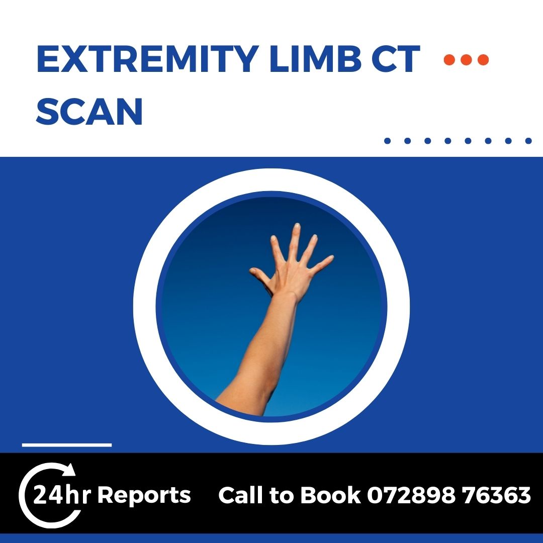 Extremity Limb CT Scan