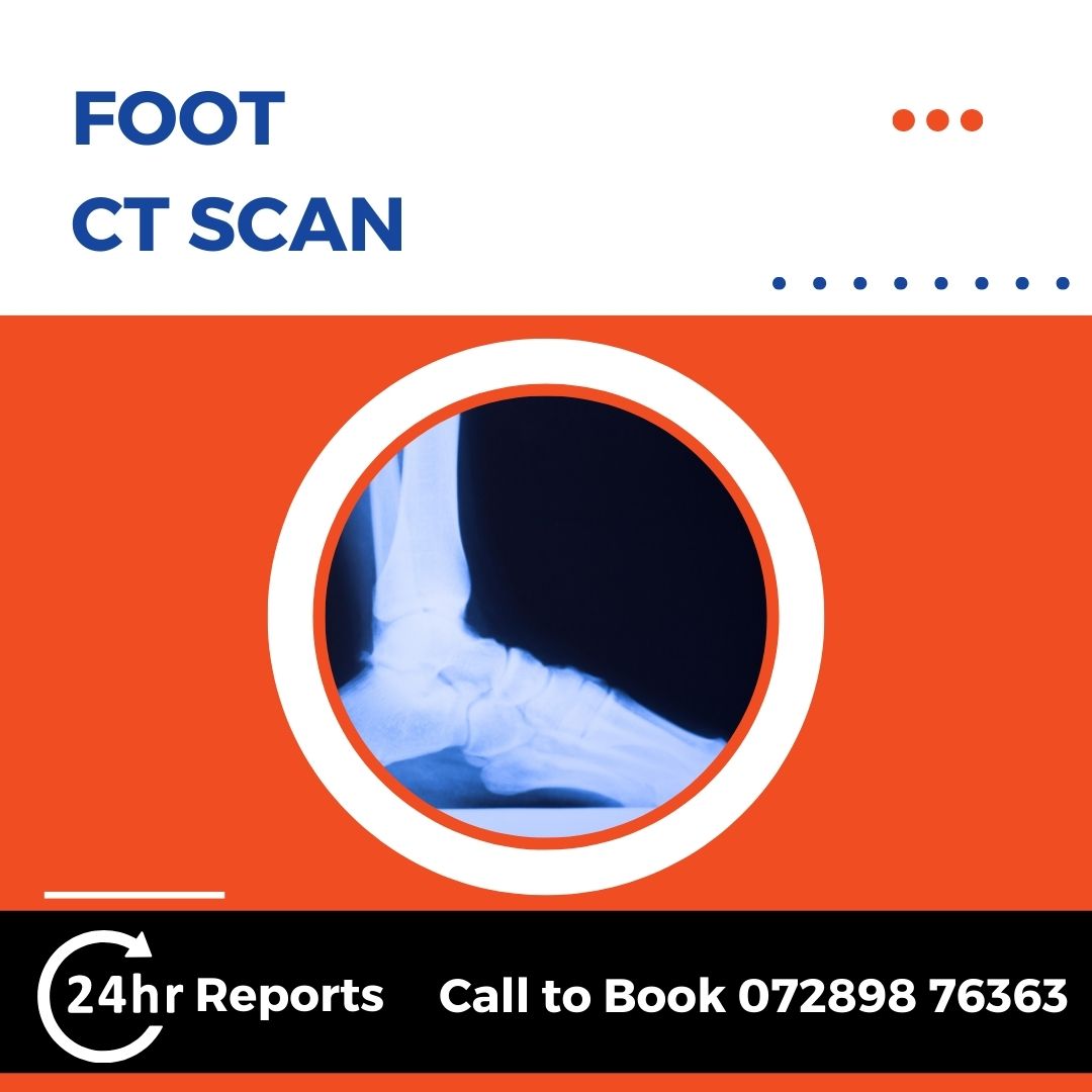 Foot CT Scan