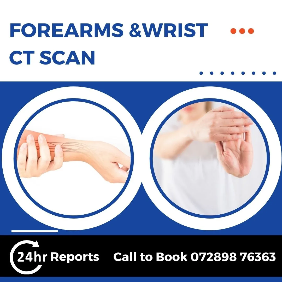 Forearms And Wrist CT Scan