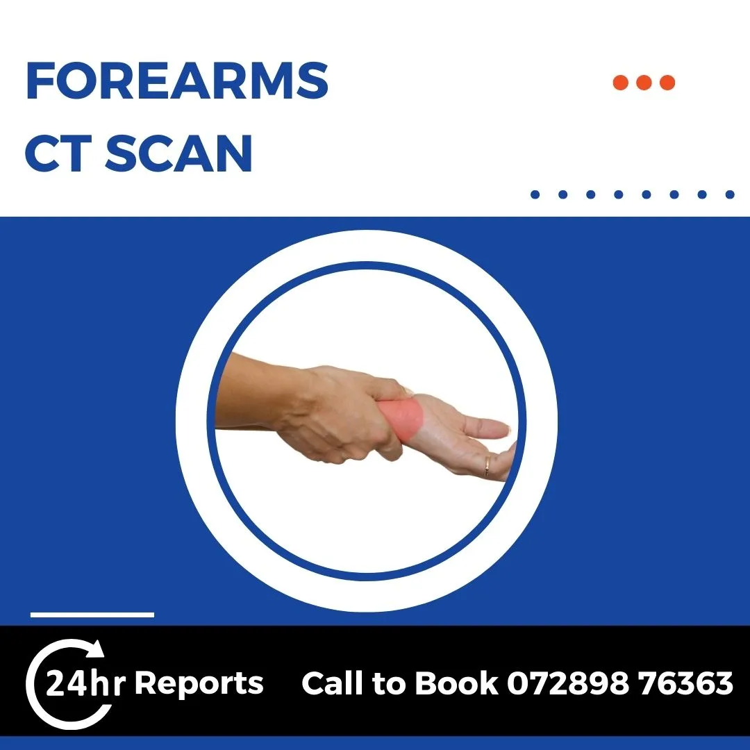 Forearms CT Scan