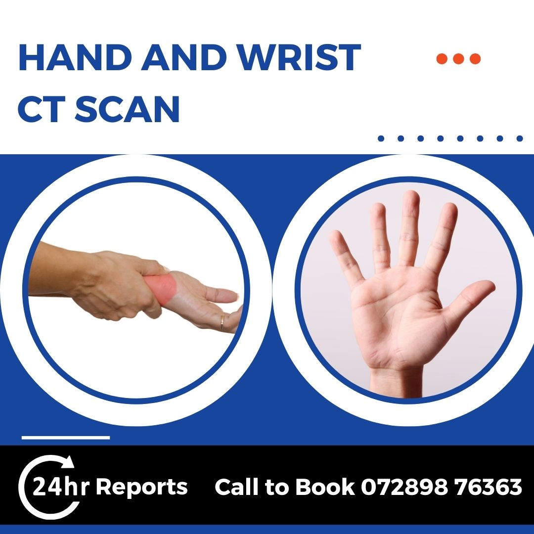 Hand And Wrist CT Scan