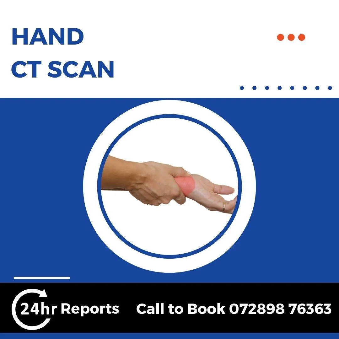 Hand CT Scan