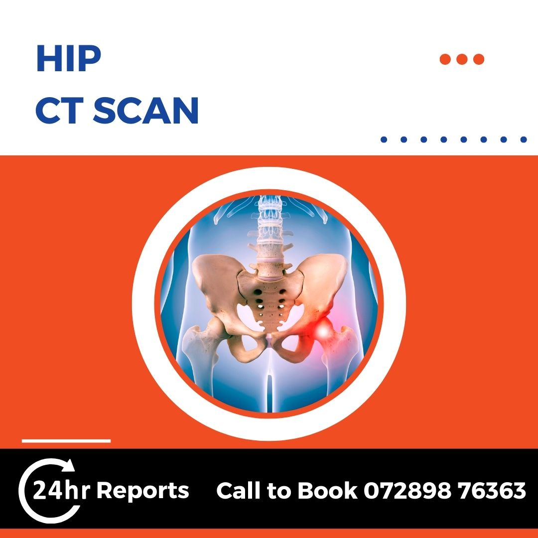 Hip CT Scan