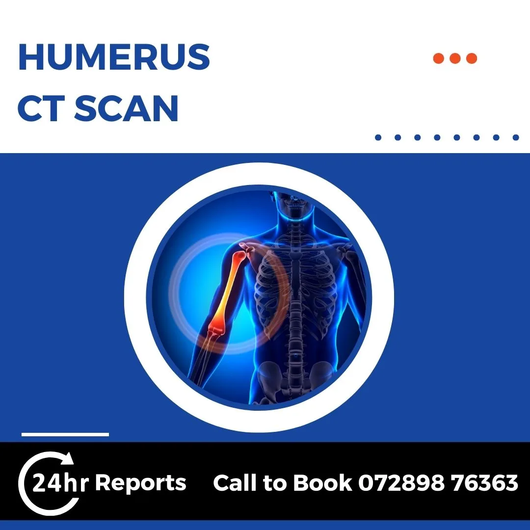 Humerus CT Scan