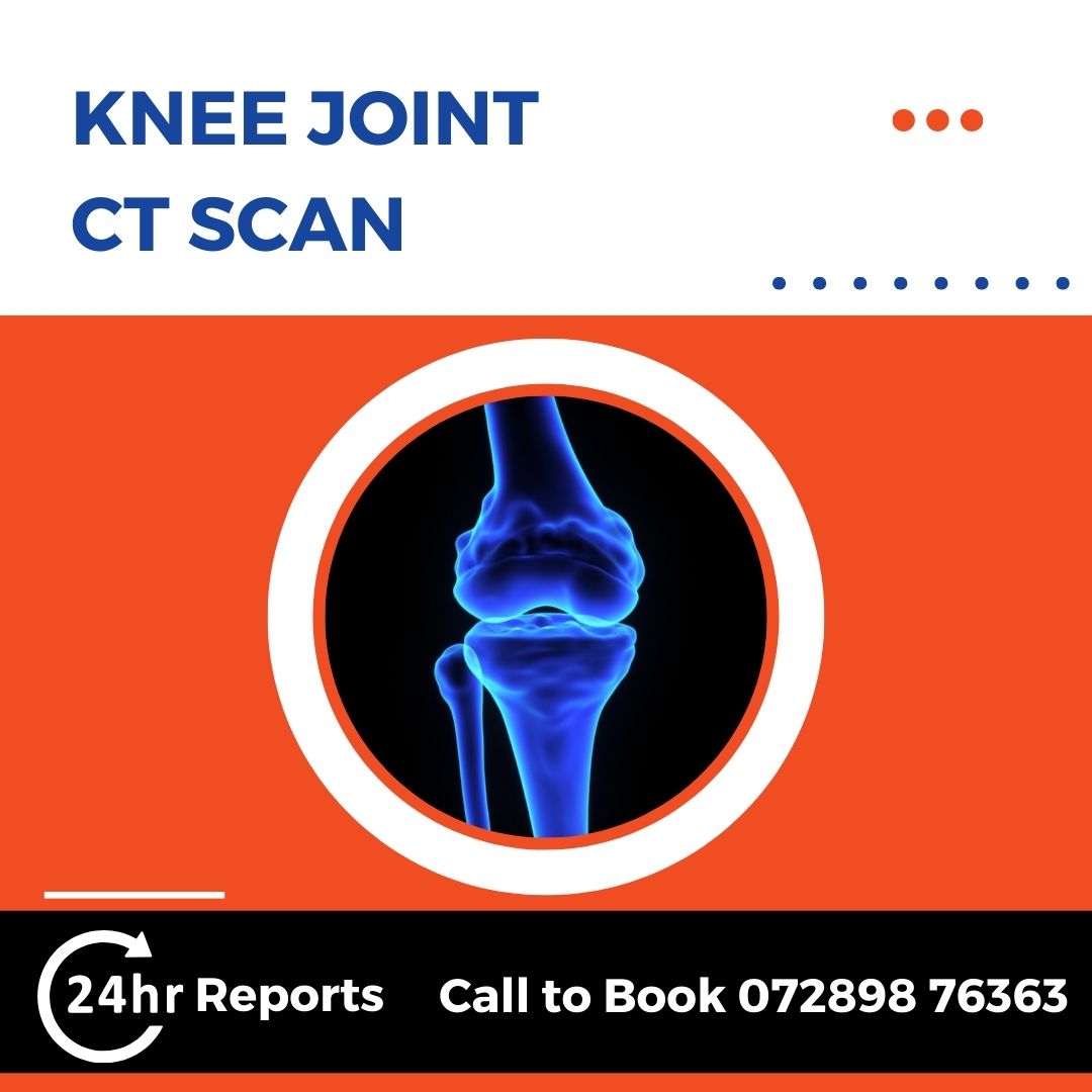 Knee Joint CT Scan
