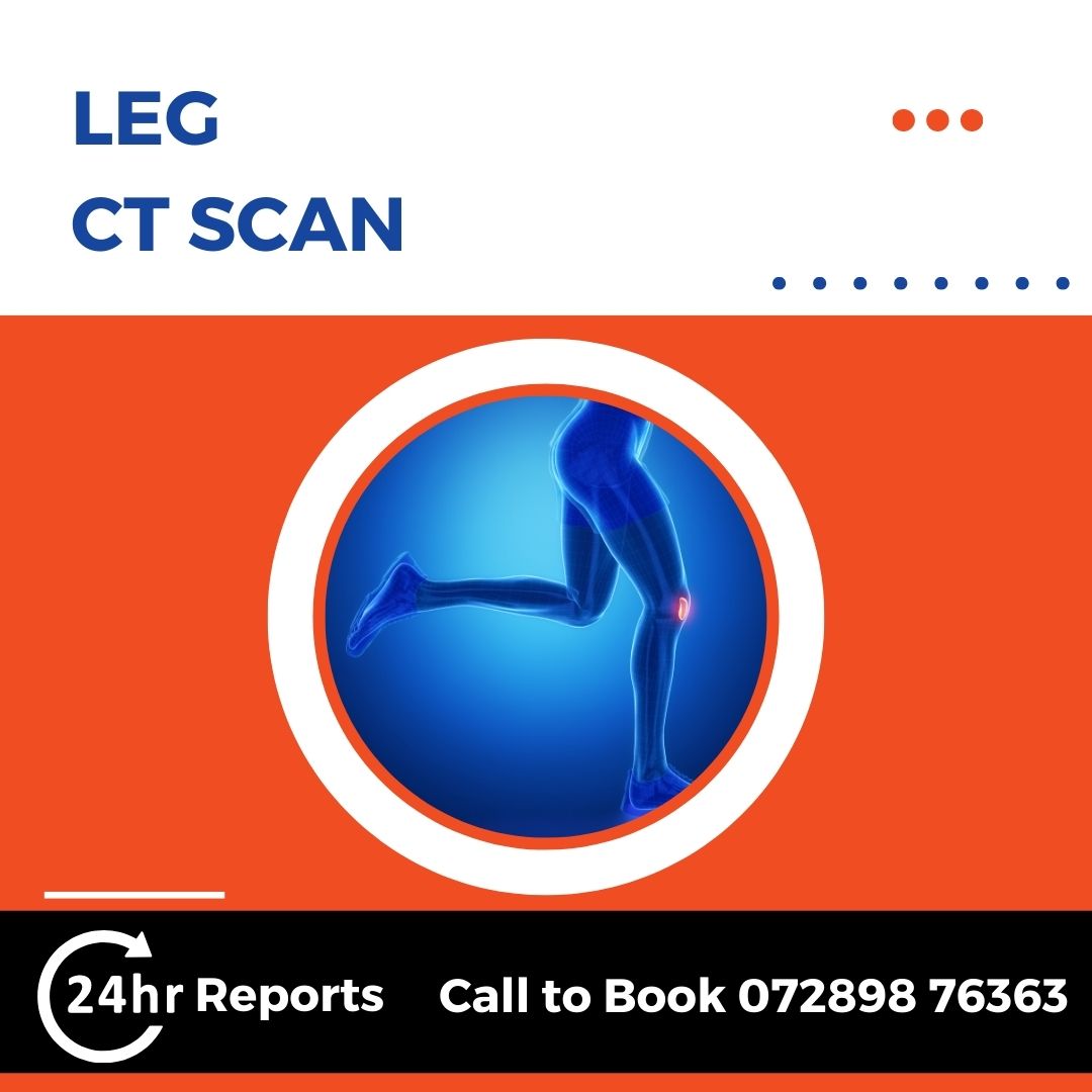 Leg CT Scan