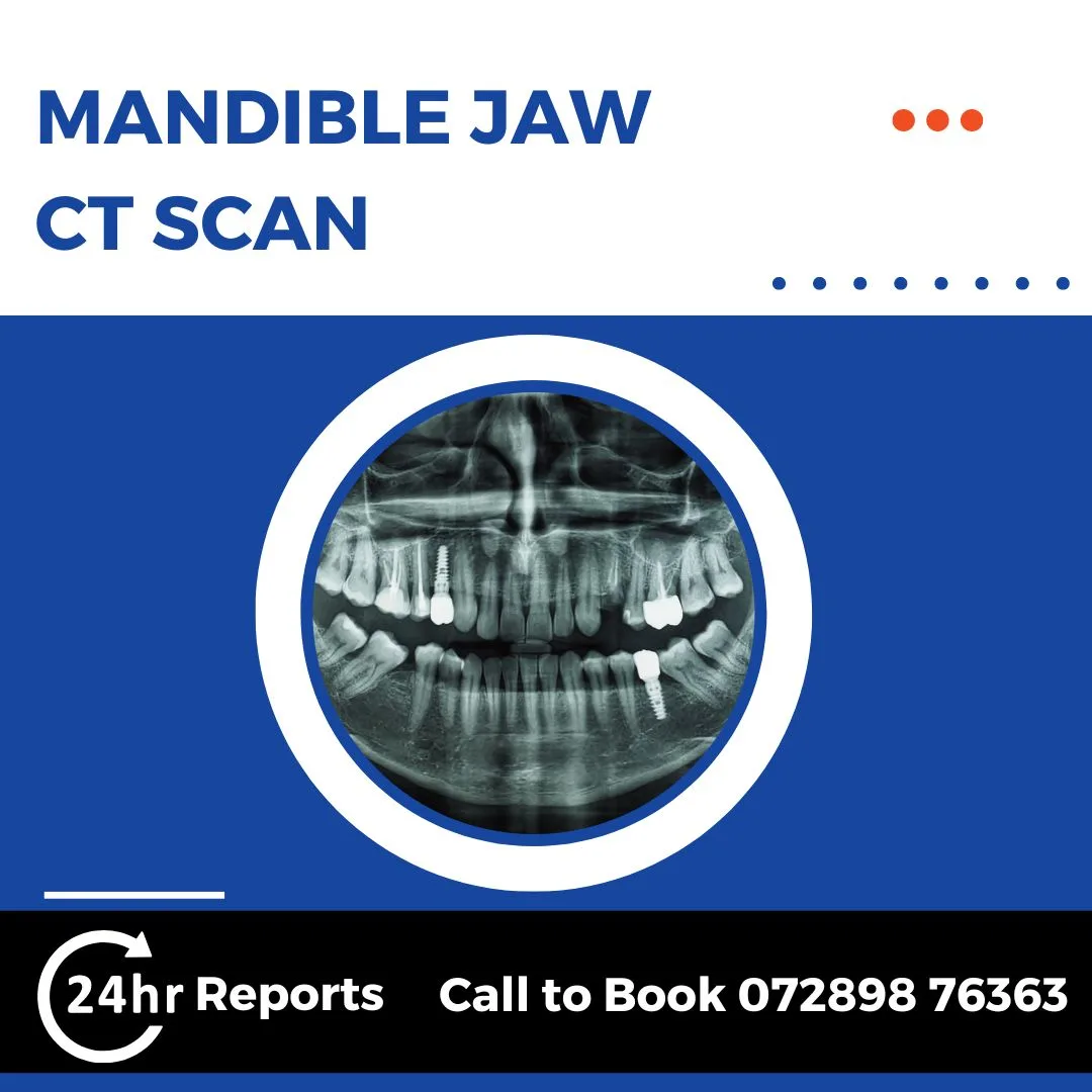 Mandible Jaw CT Scan