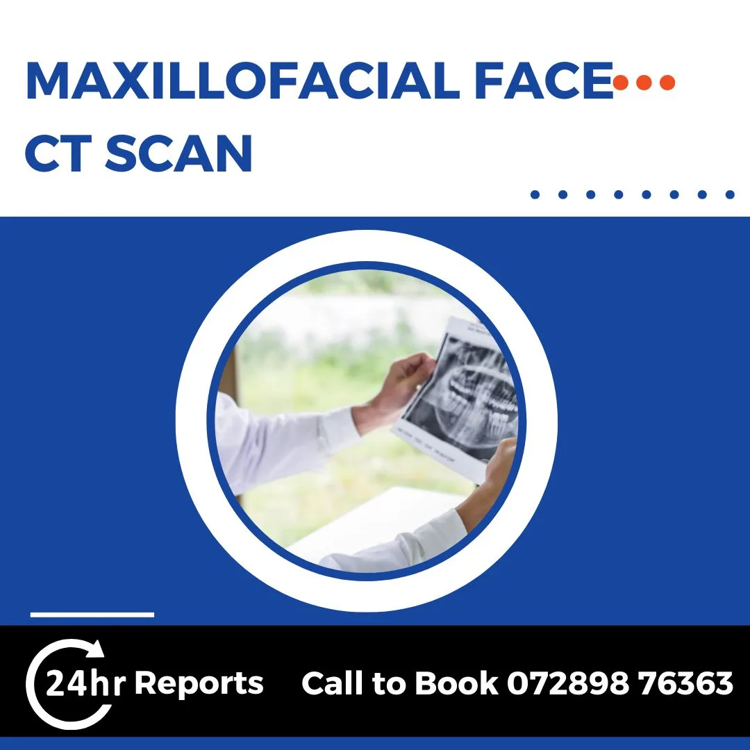 Maxillofacial Face CT Scan