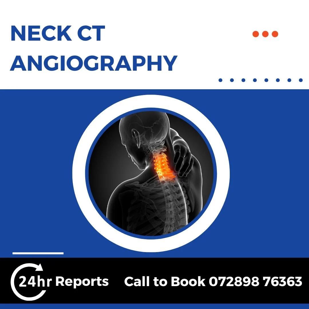 Neck CT Angiography