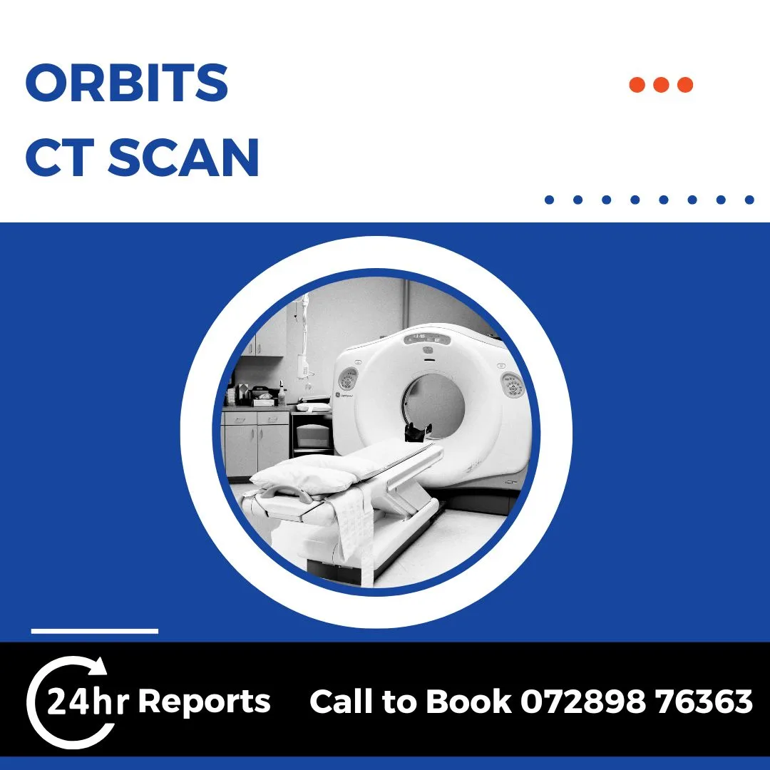 Orbits CT Scan