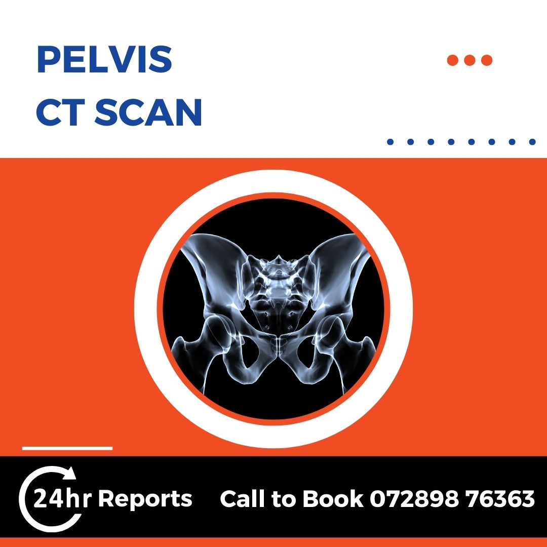 Pelvis CT Scan