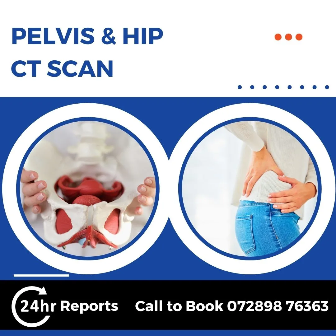 Pelvis & Hip CT Scan