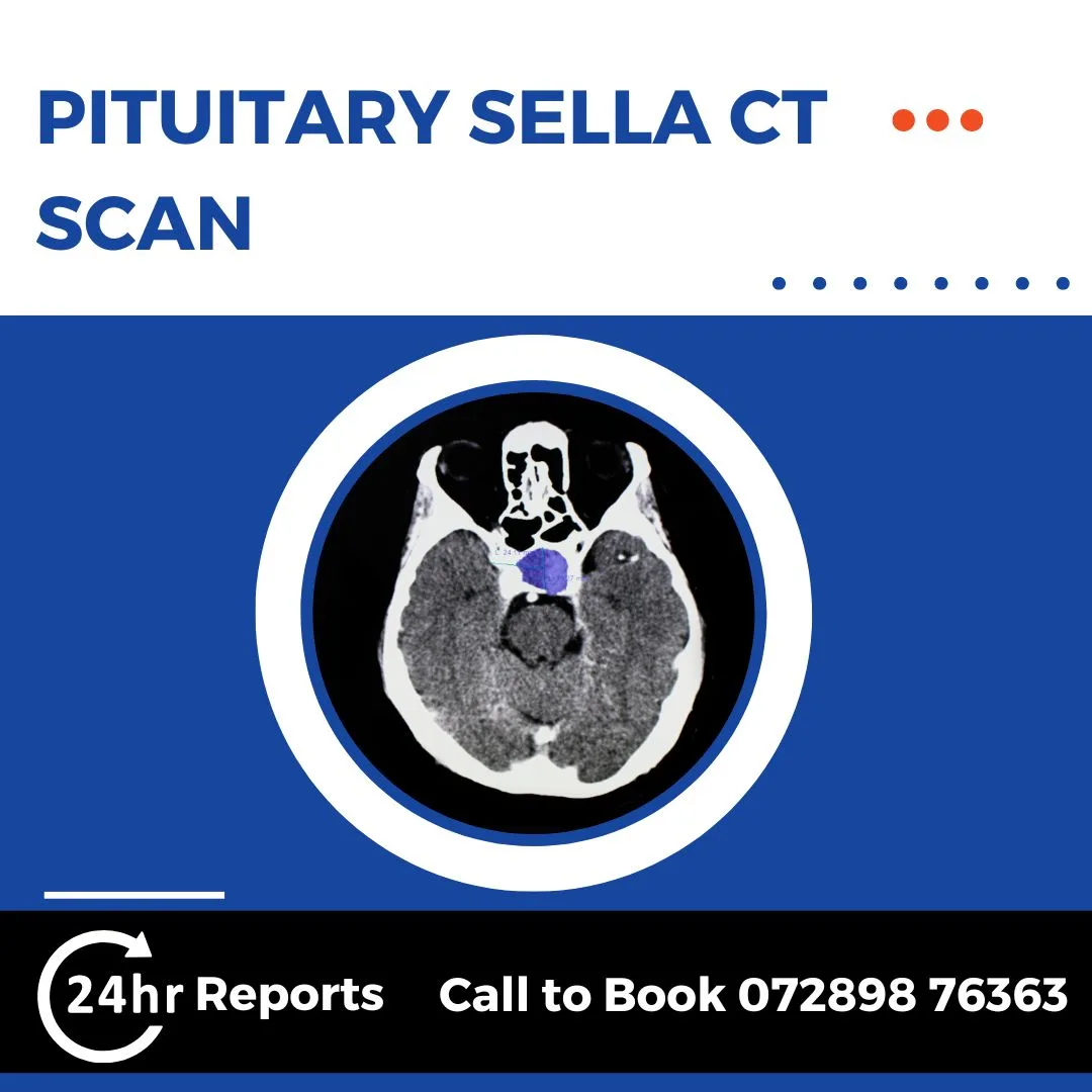 Pituitary Sella CT Scan