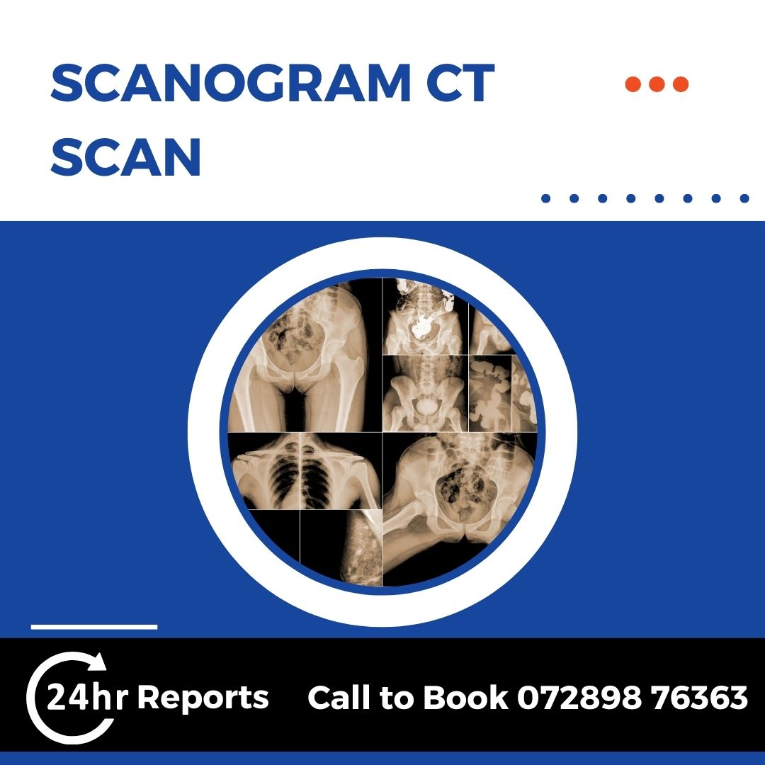 Scanogram CT Scan