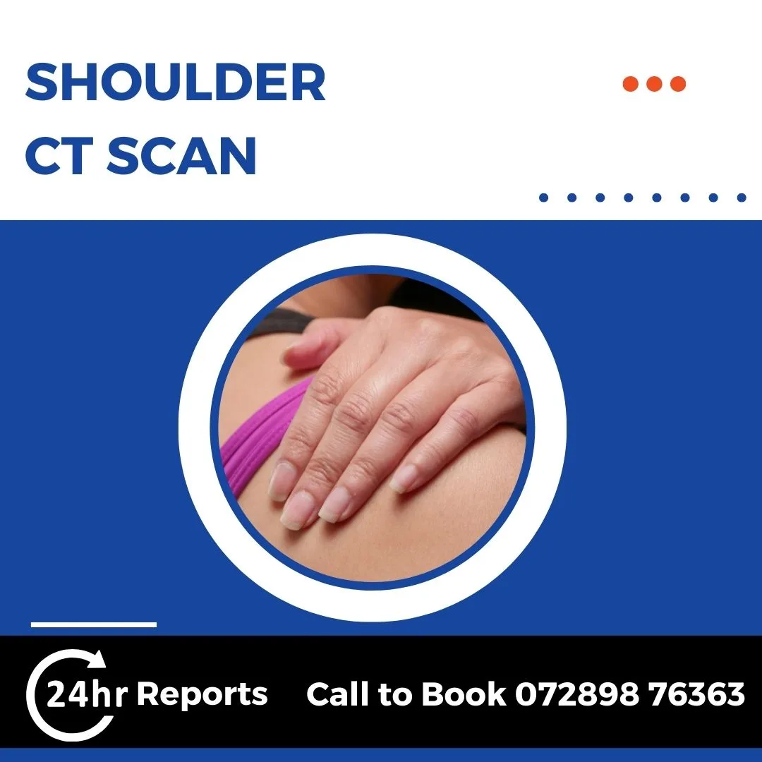 Shoulder CT Scan