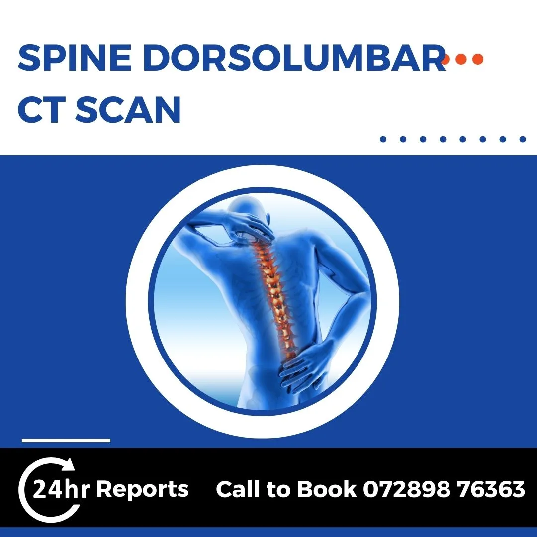 Spine Dorsolumbar CT Scan (1)
