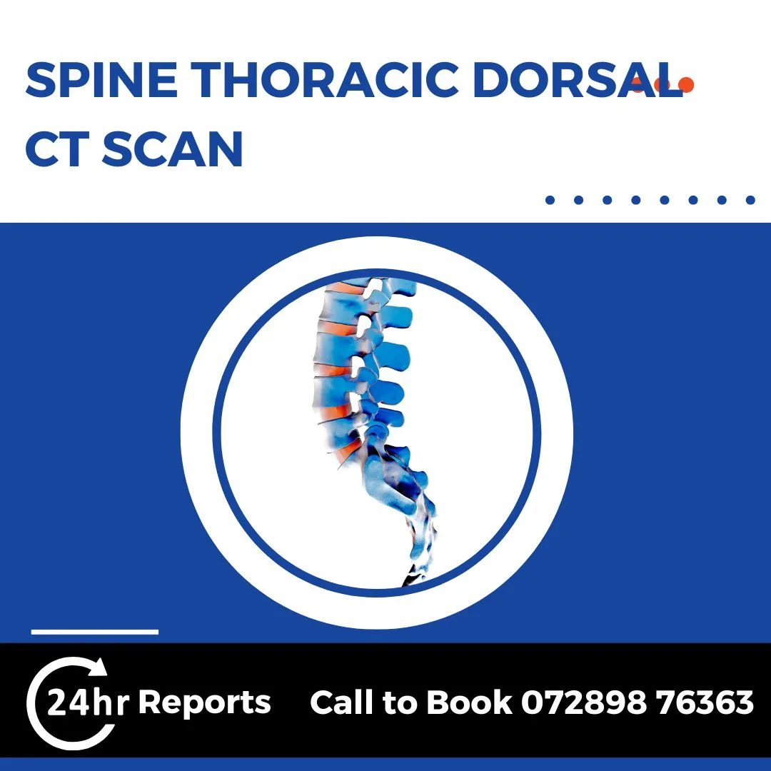 Spine Thoracic Dorsal CT Scan