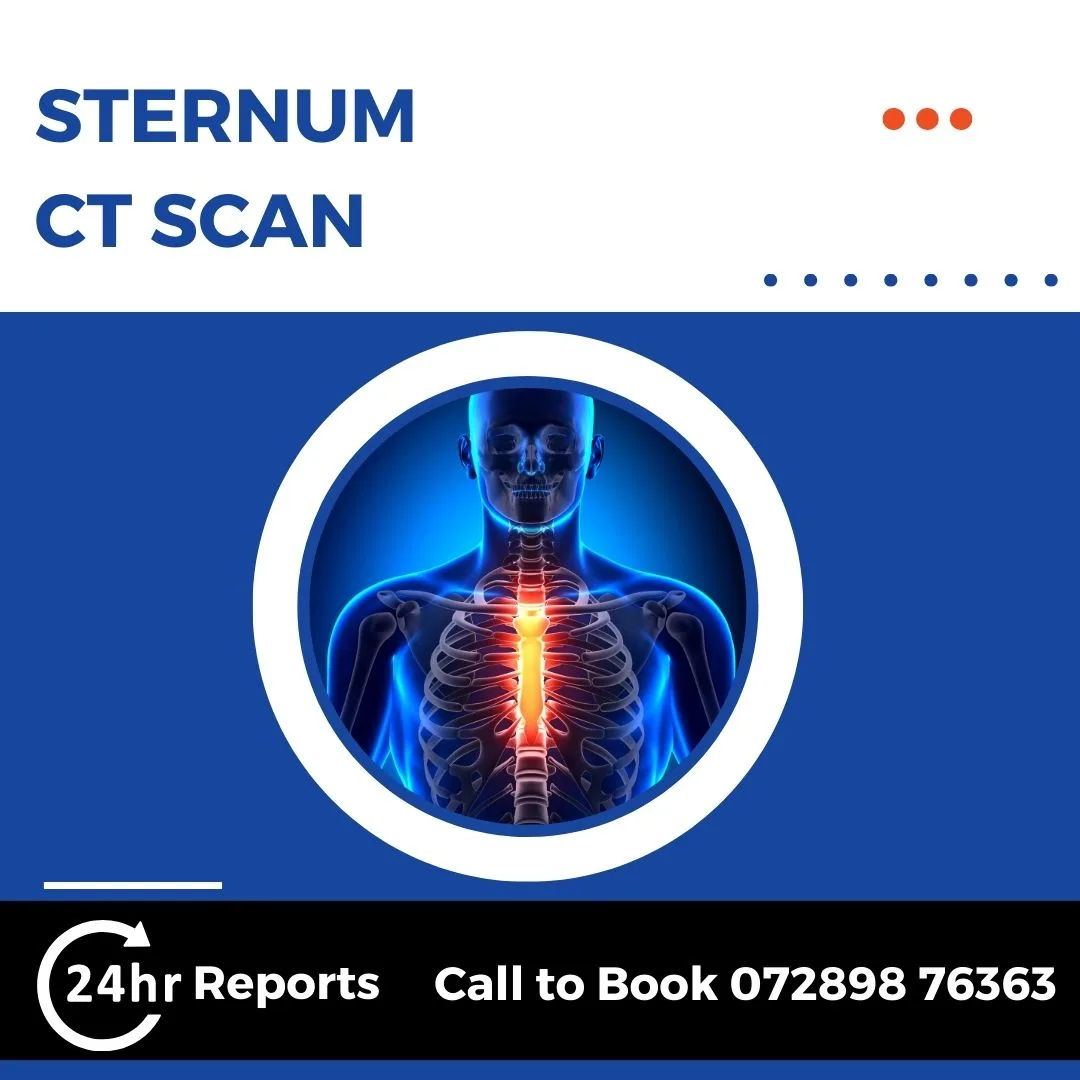 Sternum CT Scan