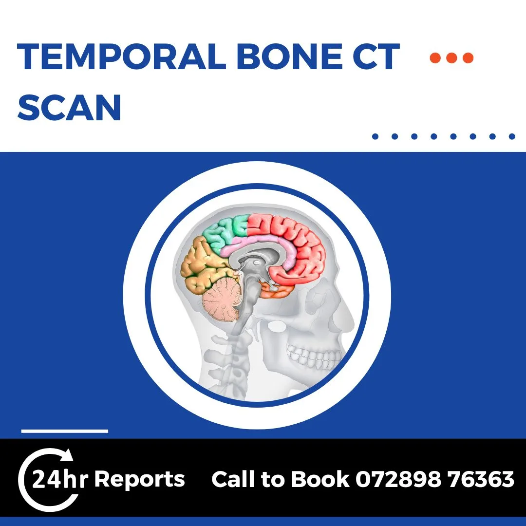 Temporal Bone CT Scan
