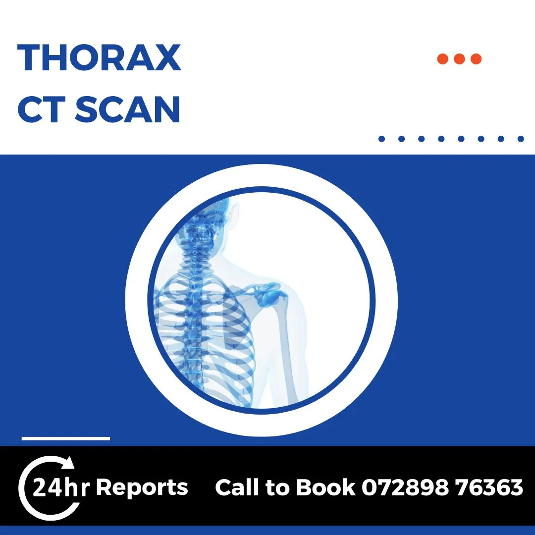 Thorax CT Scan