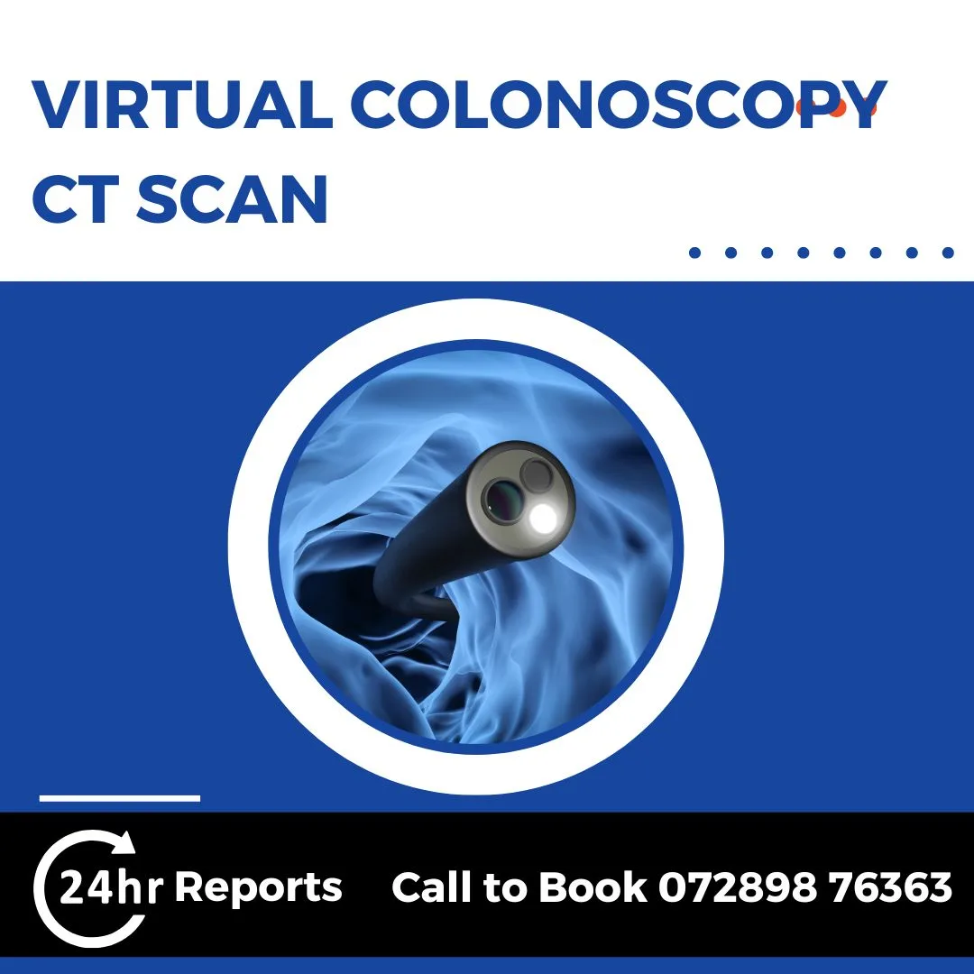 Virtual Colonoscopy CT Scan